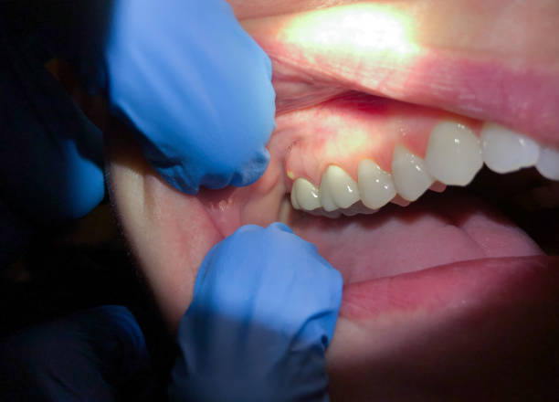 Best Weekend Emergency Dentist in Mcewen, TN